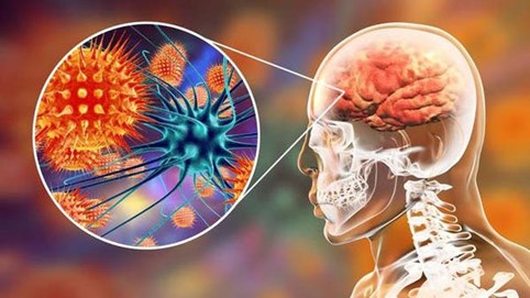 Cảnh báo một loại virus gây chết người gấp 75 lần virus Corona