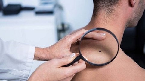 10 dấu hiệu lạ trên da 