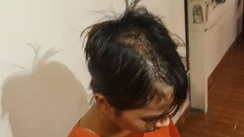 Vụ thiếu nữ 14 tuổi bị nhóm thanh niên truy sát giữa khuya: Nghi vấn chém nhầm người