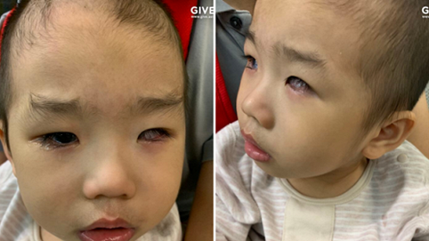 Hành trình tìm lại ánh sáng cho đứa bé đã hơn một lần bị bác sĩ từ chối chữa trị