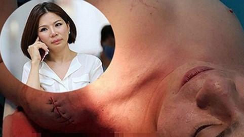 Thông tin mới vụ bác sĩ Chiêm Quốc Thái bị truy sát giữa trung tâm Sài Gòn