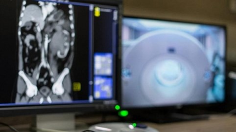 AI mất 20 giây để chẩn đoán bệnh nhân mắc Covid-19