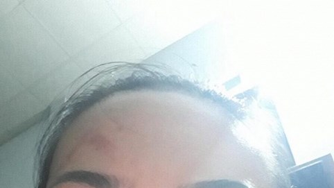 Kon Tum: Cần xử lý nghiêm vụ Công ty TNHH Tài Hồng Nhung thuê “giang hồ” hành hung người dân