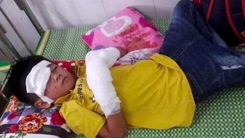 Nóng 24h qua: Điện thoại phát nổ, bé 7 tuổi dập nát bàn tay