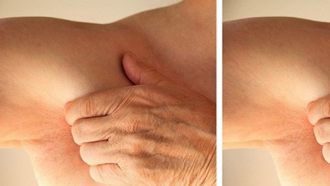 6 dấu hiệu ở nách cảnh báo sức khỏe có vấn đề: Hãy xem để biết gan bị nhiễm độc
