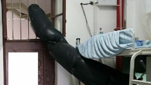 Bất đắc dĩ ở cùng người hút thuốc, làm cách nào hạn chế ung thư?