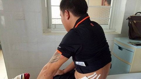 Truy sát bằng súng tại quán Karaoke, 4 người nhập viện