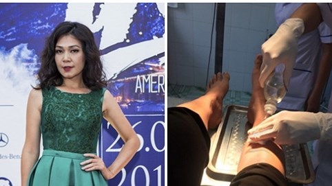 Diễn viên Đinh Y Nhung bị tai nạn ôtô khi đi quay tại Ninh Bình