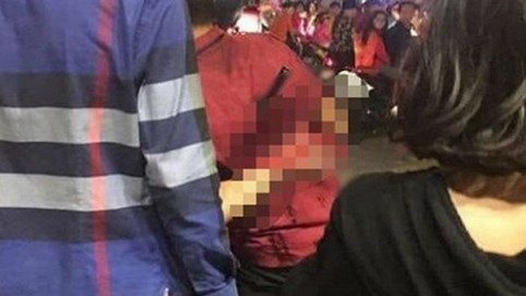 Nam thanh niên bị đâm trong đêm ăn mừng chiến thắng đội tuyển Việt Nam