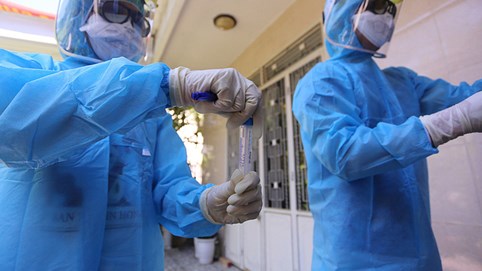 Thêm 17 ca mắc Covid-19 mới, Bình Dương có trường hợp lây nhiễm đầu tiên