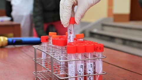 Hà Nội: Thêm 07 trường hợp dương tính SARS-CoV-2