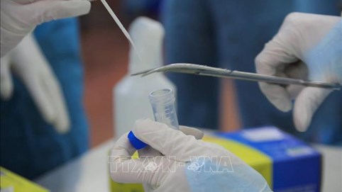 Hải Dương có thêm một đơn vị được xét nghiệm khẳng định virus SARS-CoV-2