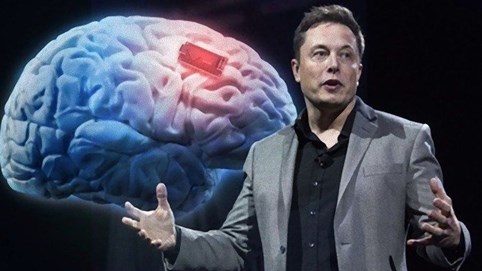Dự án chip thần kinh của Elon Musk sẽ thử nghiệm lên người trong 6 tháng tới