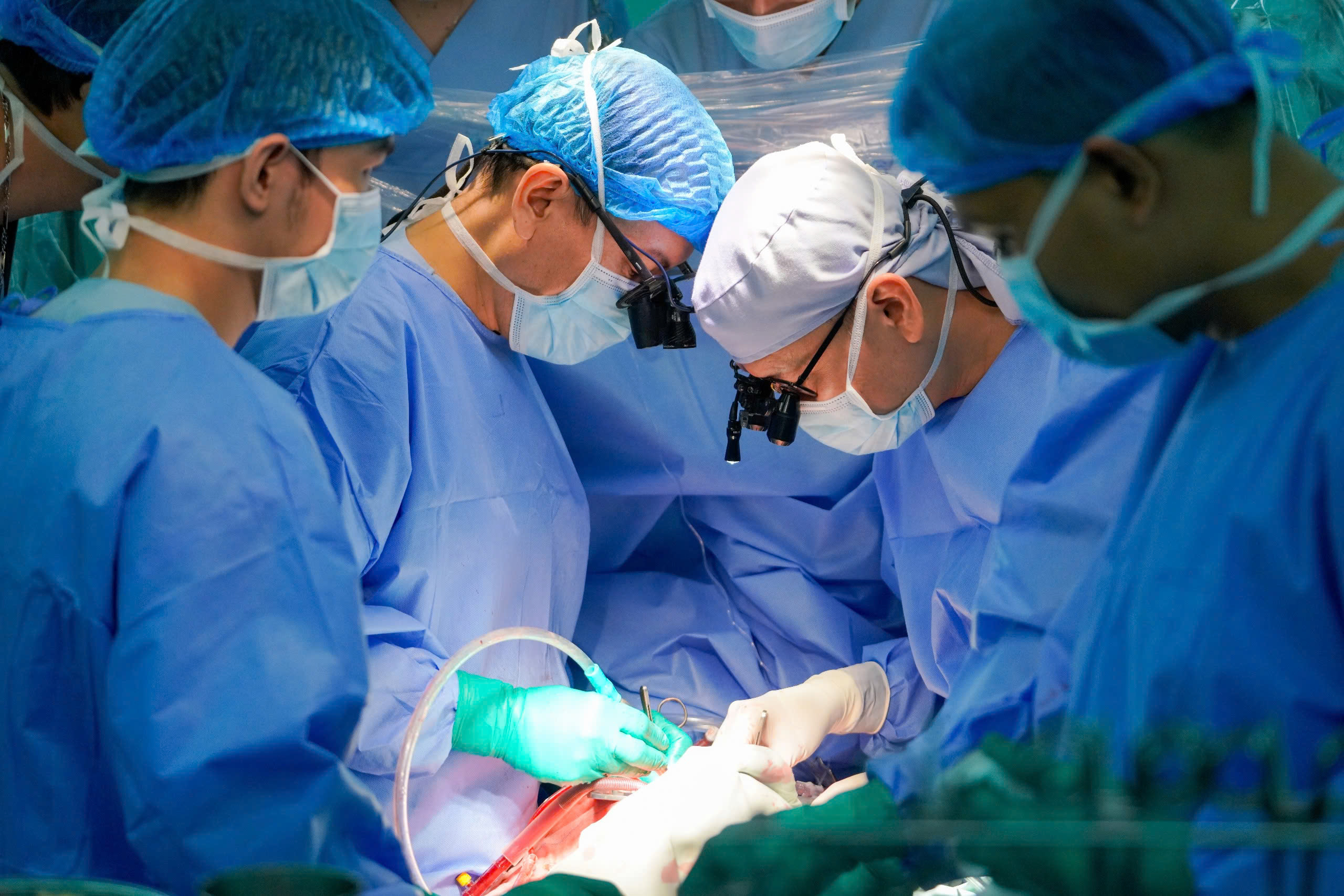 GS TS BS. Nguyễn Hoàng Định – Phó Giám đốc BV ĐHYD cùng ekip thực hiện ghép tim cho bệnh nhi