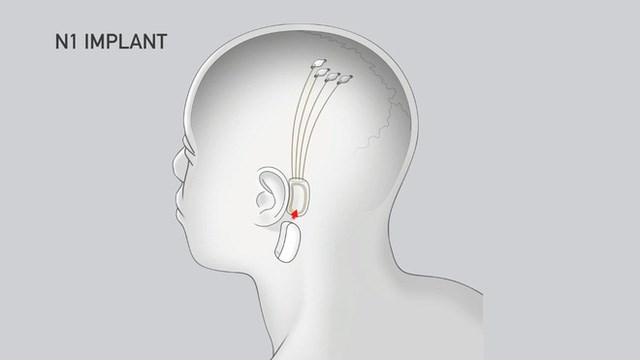 Sợ bị AI vượt mặt, Elon Musk muốn d&#249;ng Neuralink để n&#226;ng cấp khả năng con người - Ảnh 2