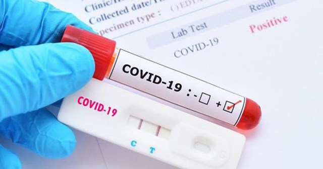 Người ti&ecirc;u d&ugrave;ng kh&ocirc;ng n&ecirc;n mua kit test Covid-19 tr&ocirc;i nổi tr&ecirc;n mạng x&atilde; hội. &nbsp;