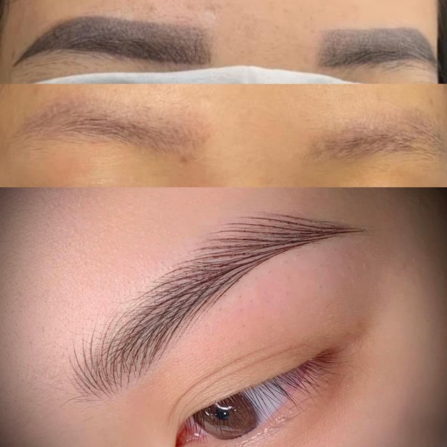 Xo&aacute; xanh đen c&ocirc;ng nghệ đạt FDA
