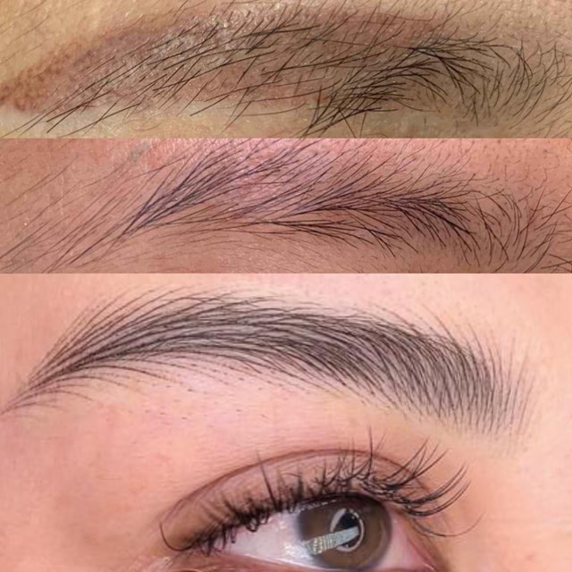 Xo&aacute; đỏ c&ocirc;ng nghệ đạt FDA